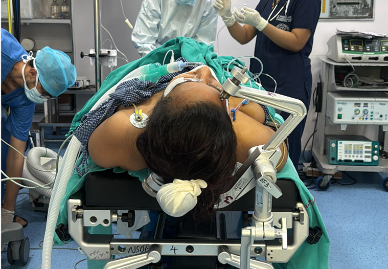 Figure 3. Digital subtraction angiography (oblique view) demonstrating bilobed left ICA bifurcation aneurysm with severe vasospasm involving the supraclinoid ICA, ACA, and MCA.